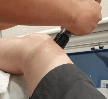 쇼크웨이브 시술 장면2