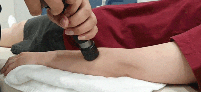 쇼크웨이브 시술 장면3